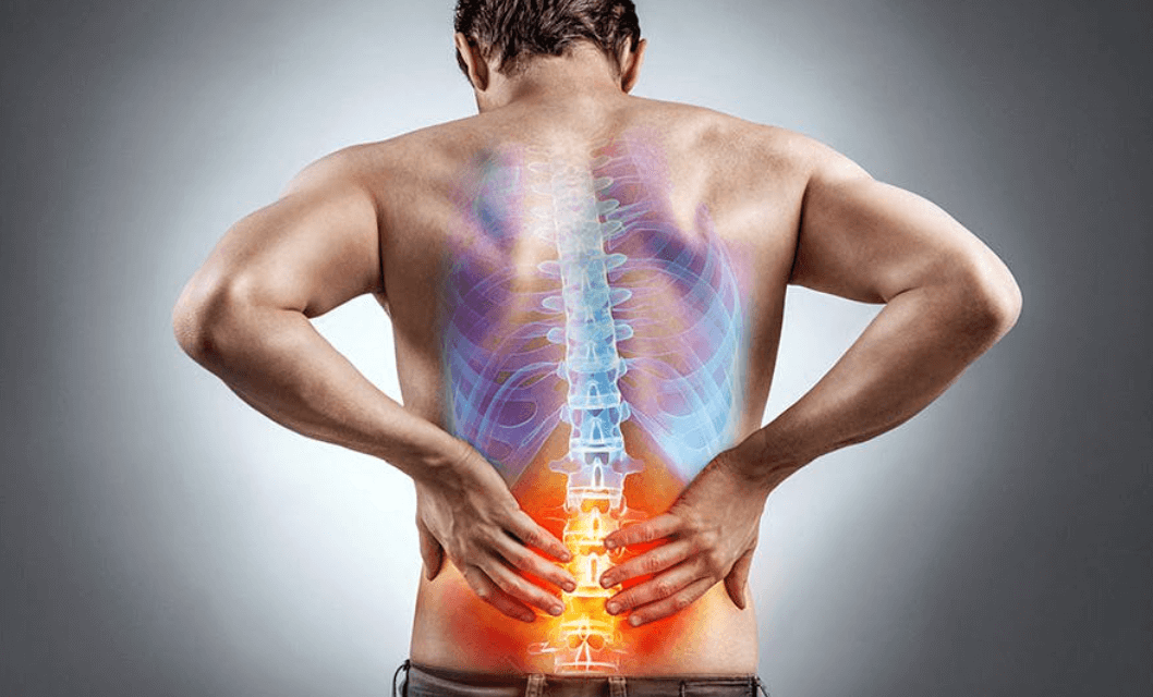 Getting Relief From Sciatica Pain